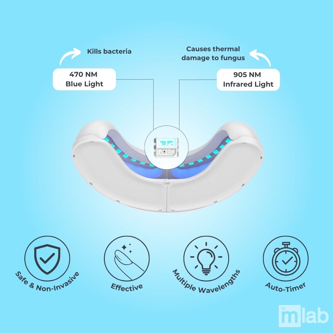 OnyCure™️ - Nail Fungus Laser