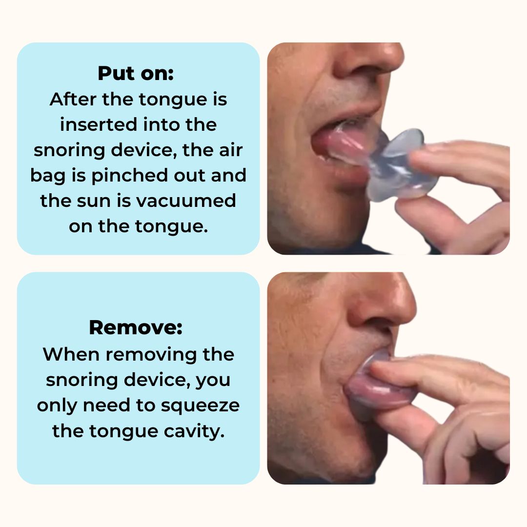 SnoreShield™ - Anti Snoring Device